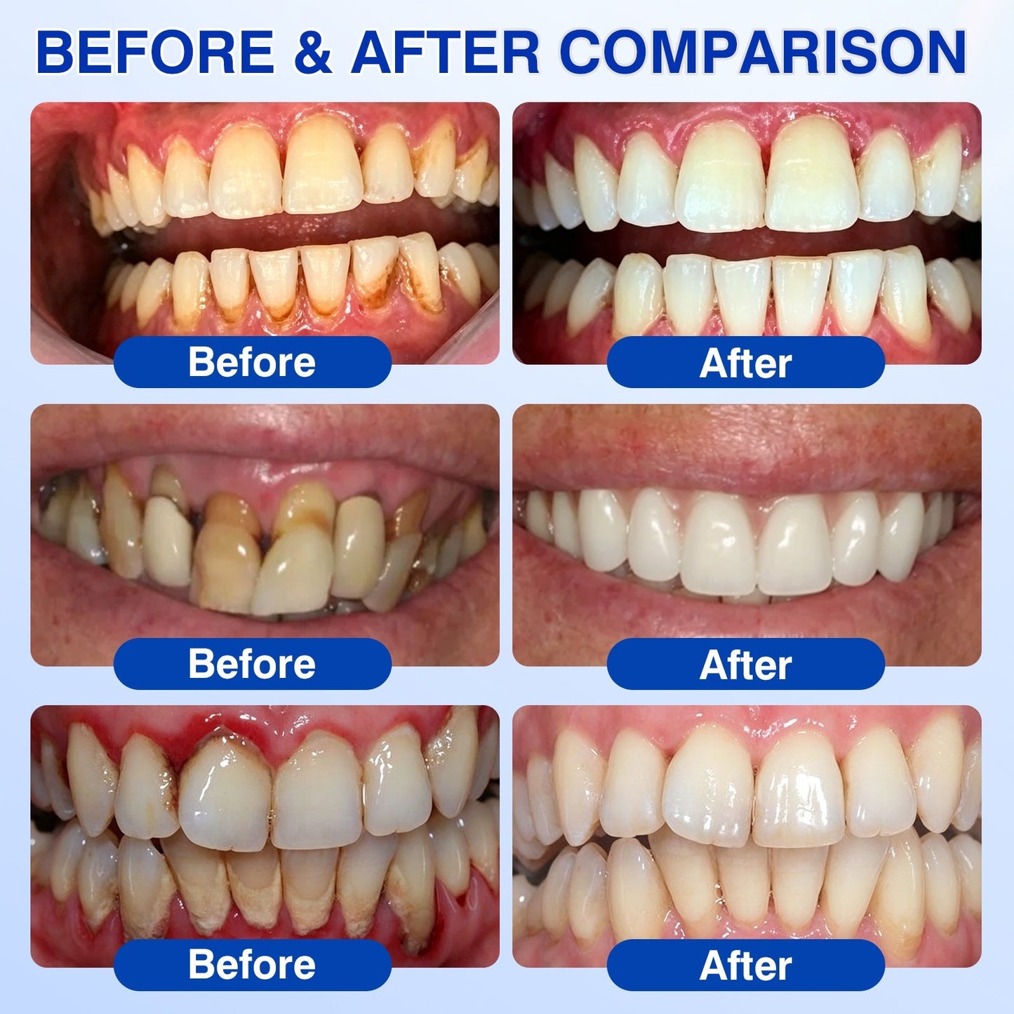 🇺🇸🏅🦷🛡️Dr.Era® GumRevive Periodontal Repair Gel