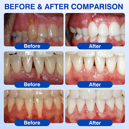 🇺🇸🏅🦷🛡️Dr.Era® GumRevive Periodontal Repair Gel