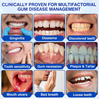 🇺🇸🏅🦷🛡️Dr.Era® GumRevive Periodontal Repair Gel