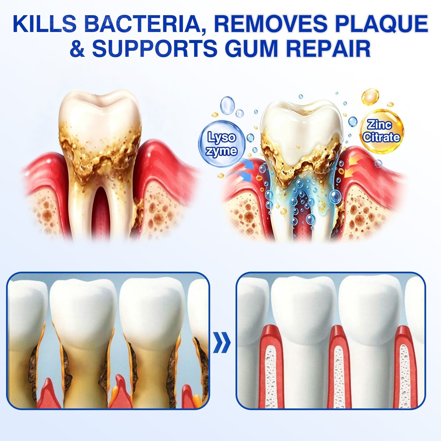 🇺🇸🏅🦷🛡️Dr.Era® GumRevive Periodontal Repair Gel