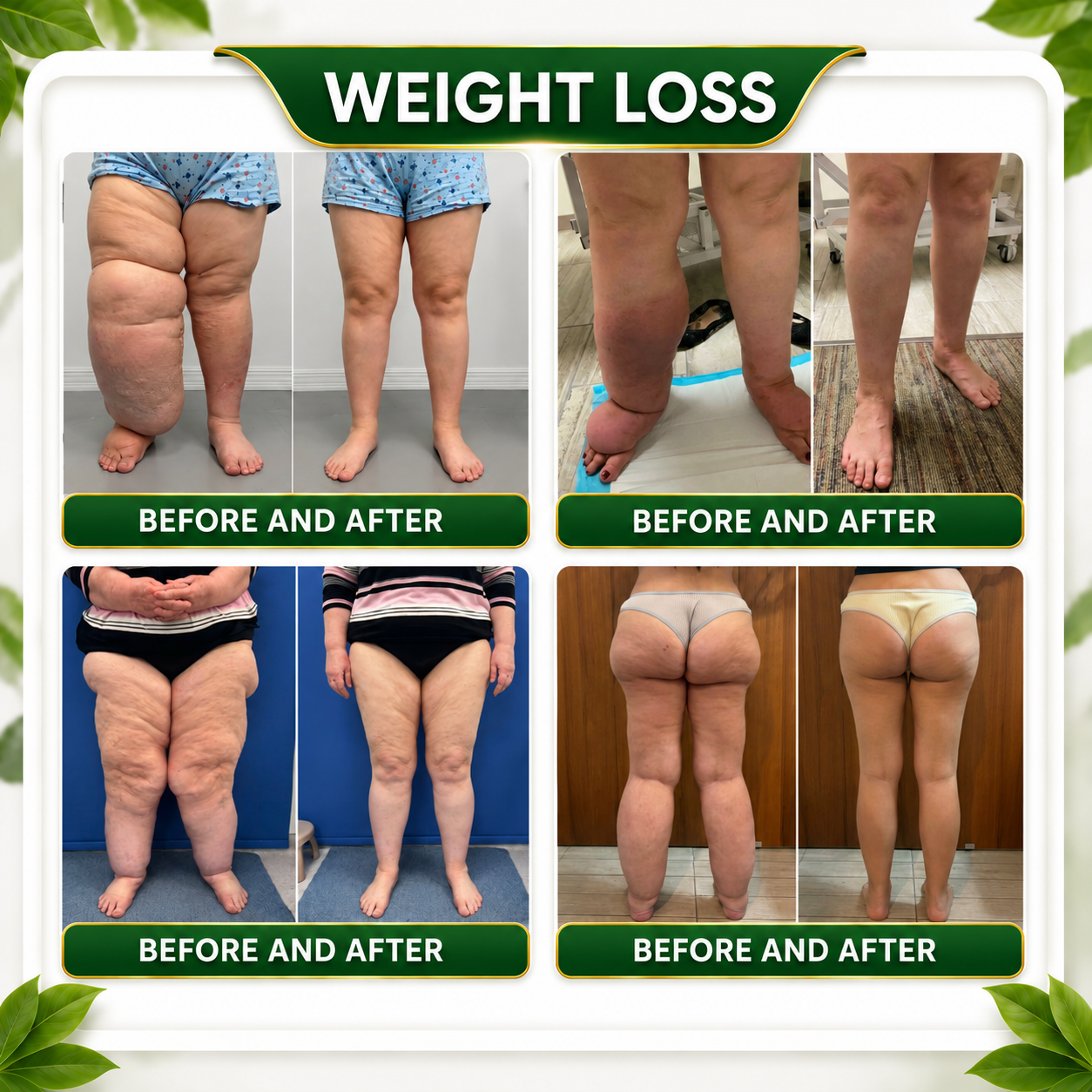 𝑮𝒓𝒆𝒆𝒏𝑭𝒆𝒆𝒍® 10-𝒊𝒏-1 𝑩𝒆𝒓𝒃𝒆𝒓𝒊𝒏𝒆 𝑴𝒐𝒓𝒊𝒏𝒈𝒂 𝑵𝑨𝑫+ 𝑯𝒆𝒓𝒃𝒂𝒍 𝑴𝒆𝒕𝒂𝒃𝒐𝒍𝒊𝒔𝒎 𝑭𝒐𝒐𝒕 𝑺𝒐𝒂𝒌 𝑩𝒆𝒂𝒅𝒔