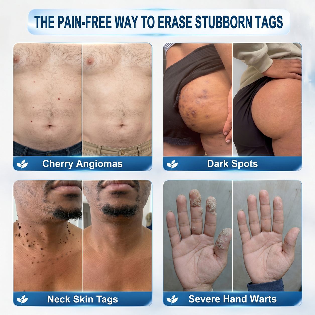 Hiskin® has a surprise upgrade just for you! You've already got an amazing offer — but now you've unlocked an even better one:👉 You'll get a massive 30% off your next purchase — for the next five minutes only!